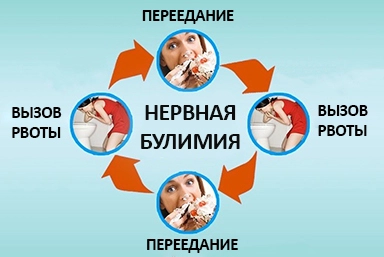Лечение булимии в Алёшках